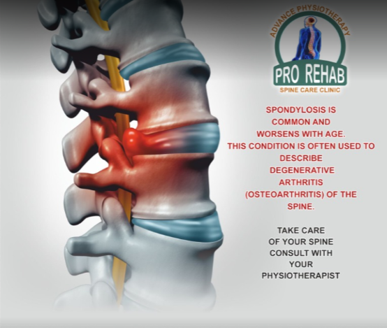 Pro Rehab Advance Physiotherapy Spine Care Clinic in Agra